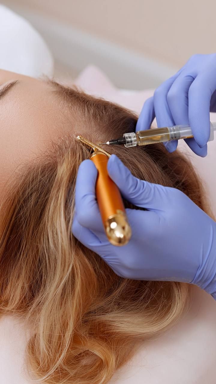 Mesoterapia Capilar Vitaminas