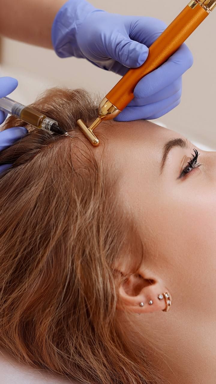 Mesoterapia Capilar Dutasteride + Minoxidil