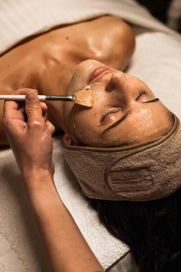 Peeling Quimico